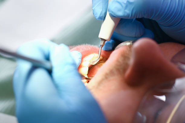 Best Walk-In Emergency Dental Services in Woodlawn Beach, FL